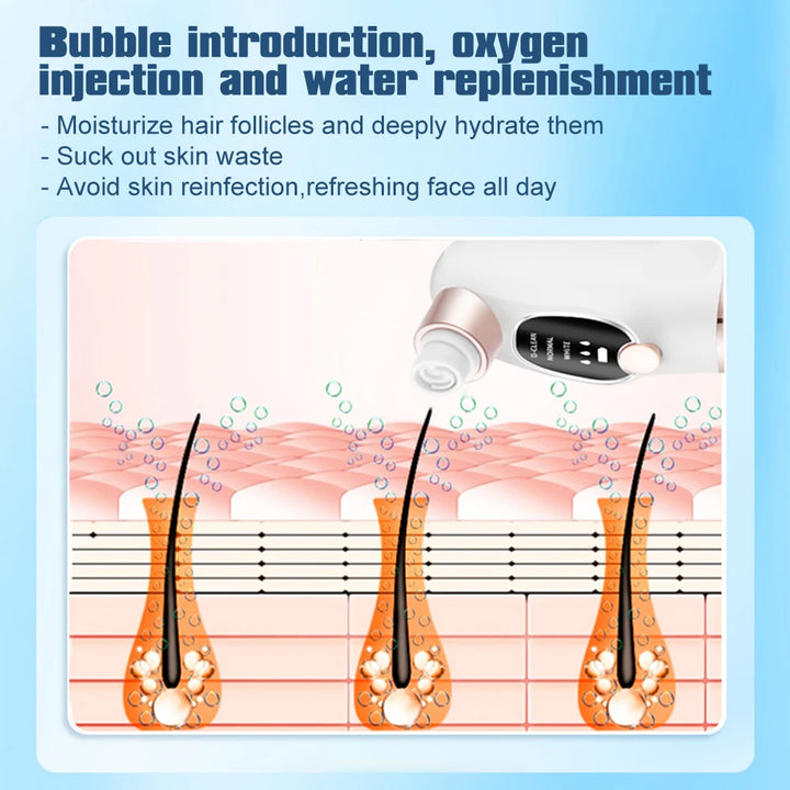 Blackhead Remover Pore Vacuum Face Cleaner Electric Pimple Black Head Removal USB Rechargeable Water Cycle Facial Cleaning Tools