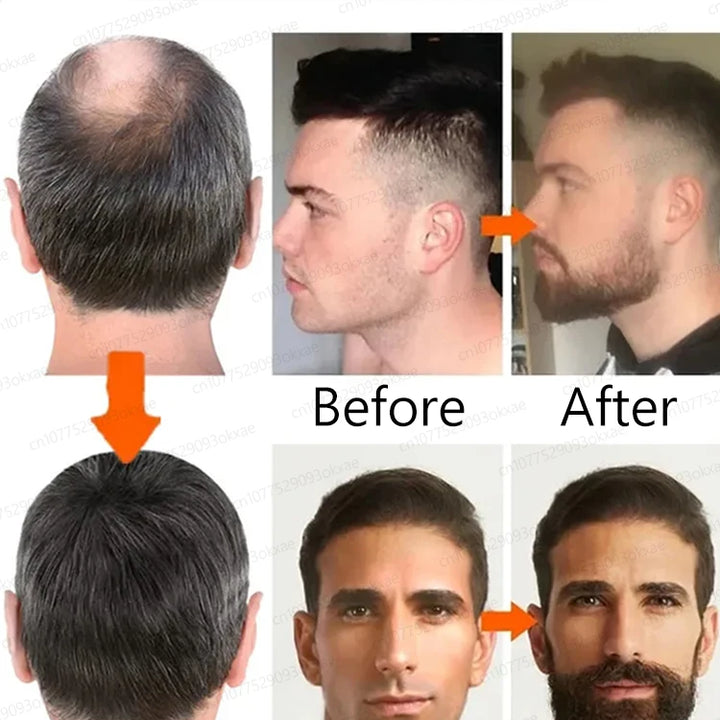 The best beard growth essential oil in the 21st century, have a mature and sexy beard, quickly grow beard, chest hair and leg ha